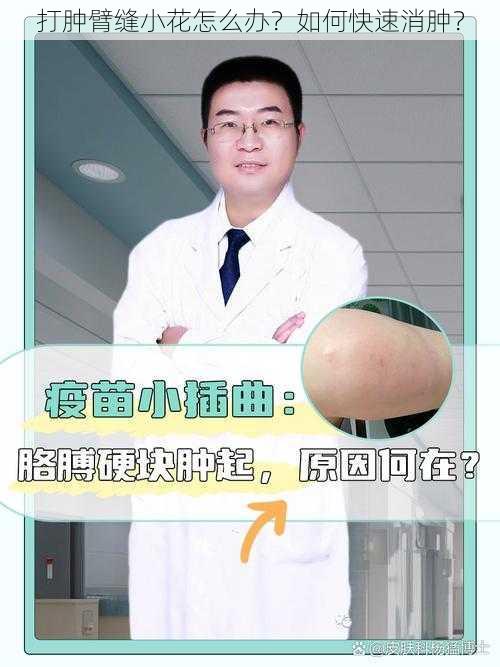 打肿臂缝小花怎么办？如何快速消肿？